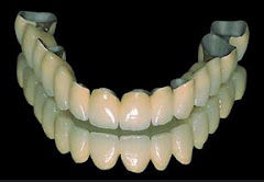 Prótesis fija: Especialidades de Clínica Dental Medicalia Fuenlabrada, tus dentistas de confianza Prótesis fija: Especialidades de Clínica Dental Medicalia Fuenlabrada, tus dentistas de confianza