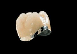 Prótesis fija: Especialidades de Clínica Dental Medicalia Fuenlabrada, tus dentistas de confianza Prótesis fija: Especialidades de Clínica Dental Medicalia Fuenlabrada, tus dentistas de confianza