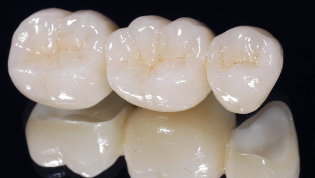Prótesis fija: Especialidades de Clínica Dental Medicalia Fuenlabrada, tus dentistas de confianza Prótesis fija: Especialidades de Clínica Dental Medicalia Fuenlabrada, tus dentistas de confianza