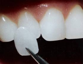 Carrilas: Especialidades de Clínica Dental Medicalia Fuenlabrada, tus dentistas de confianza Carrilas: Especialidades de Clínica Dental Medicalia Fuenlabrada, tus dentistas de confianza