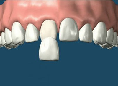 Carrilas: Especialidades de Clínica Dental Medicalia Fuenlabrada, tus dentistas de confianza Carrilas: Especialidades de Clínica Dental Medicalia Fuenlabrada, tus dentistas de confianza