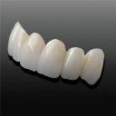 Coronas o Fundas: Especialidades de Clínica Dental Medicalia Fuenlabrada, tus dentistas de confianza Coronas o Fundas: Especialidades de Clínica Dental Medicalia Fuenlabrada, tus dentistas de confianza
