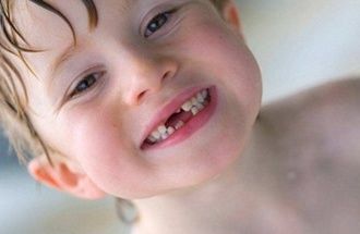 Odontopediatría : Especialidades de Clínica Dental Medicalia Fuenlabrada, tus dentistas de confianza Odontopediatría : Especialidades de Clínica Dental Medicalia Fuenlabrada, tus dentistas de confianza