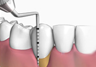 Periodoncia: Especialidades de Clínica Dental Medicalia Fuenlabrada, tus dentistas de confianza Periodoncia: Especialidades de Clínica Dental Medicalia Fuenlabrada, tus dentistas de confianza