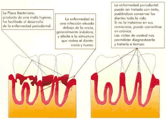 Periodoncia: Especialidades de Clínica Dental Medicalia Fuenlabrada, tus dentistas de confianza Periodoncia: Especialidades de Clínica Dental Medicalia Fuenlabrada, tus dentistas de confianza