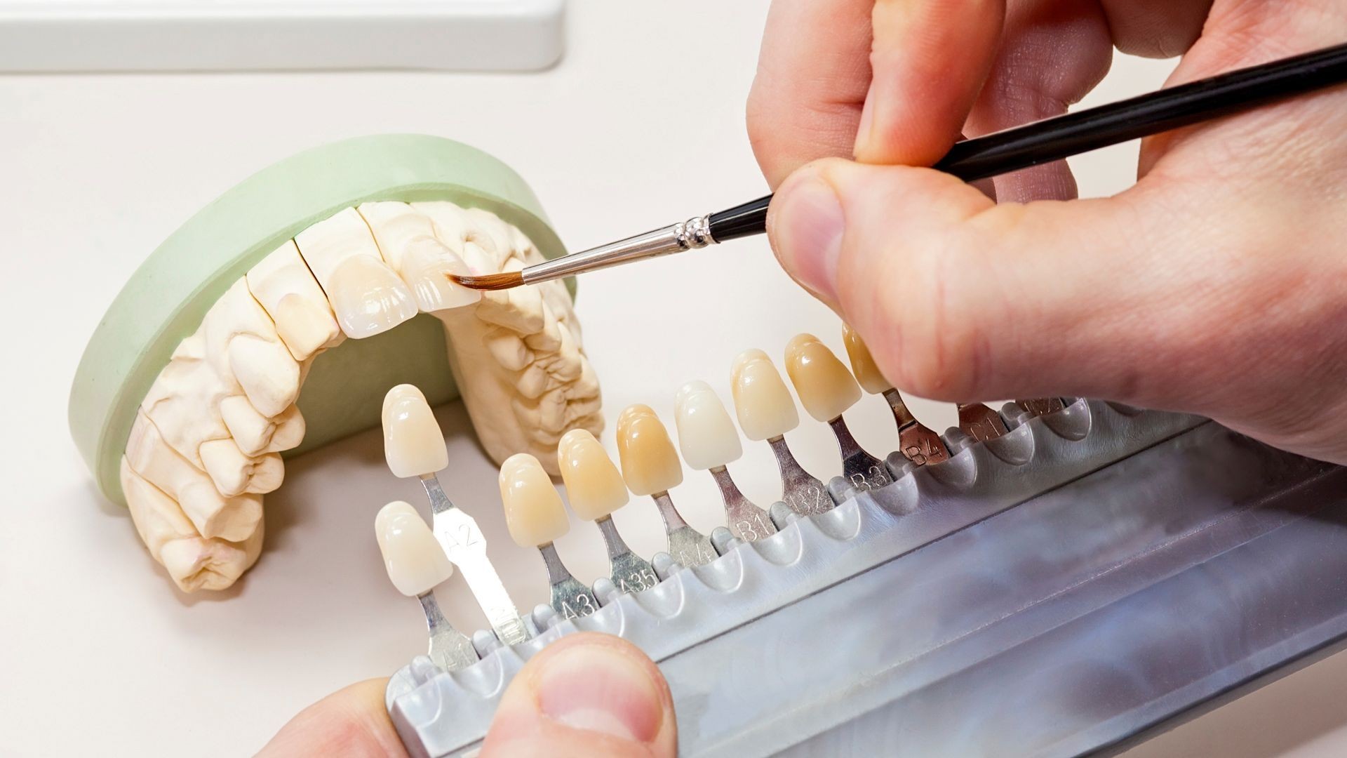 Prótesis dentales en Valencia Prótesis dentales en Valencia