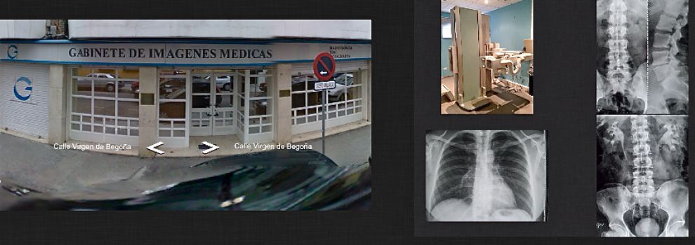 Gabinete Imagenes Medicas Virgen De Begoña | m 233 dicos especialistas radiodiagn 243 stico en sevilla Gabinete Imagenes Medicas Virgen De Begoña | m 233 dicos especialistas radiodiagn 243 stico en sevilla
