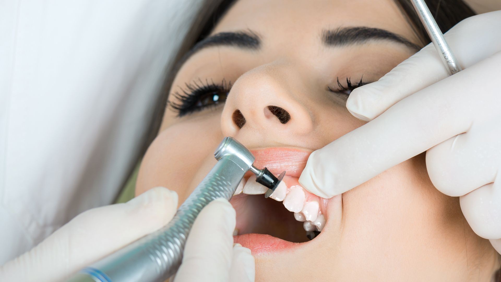 Implantes dentales en Móstoles y Valmojado Implantes dentales en Móstoles y Valmojado