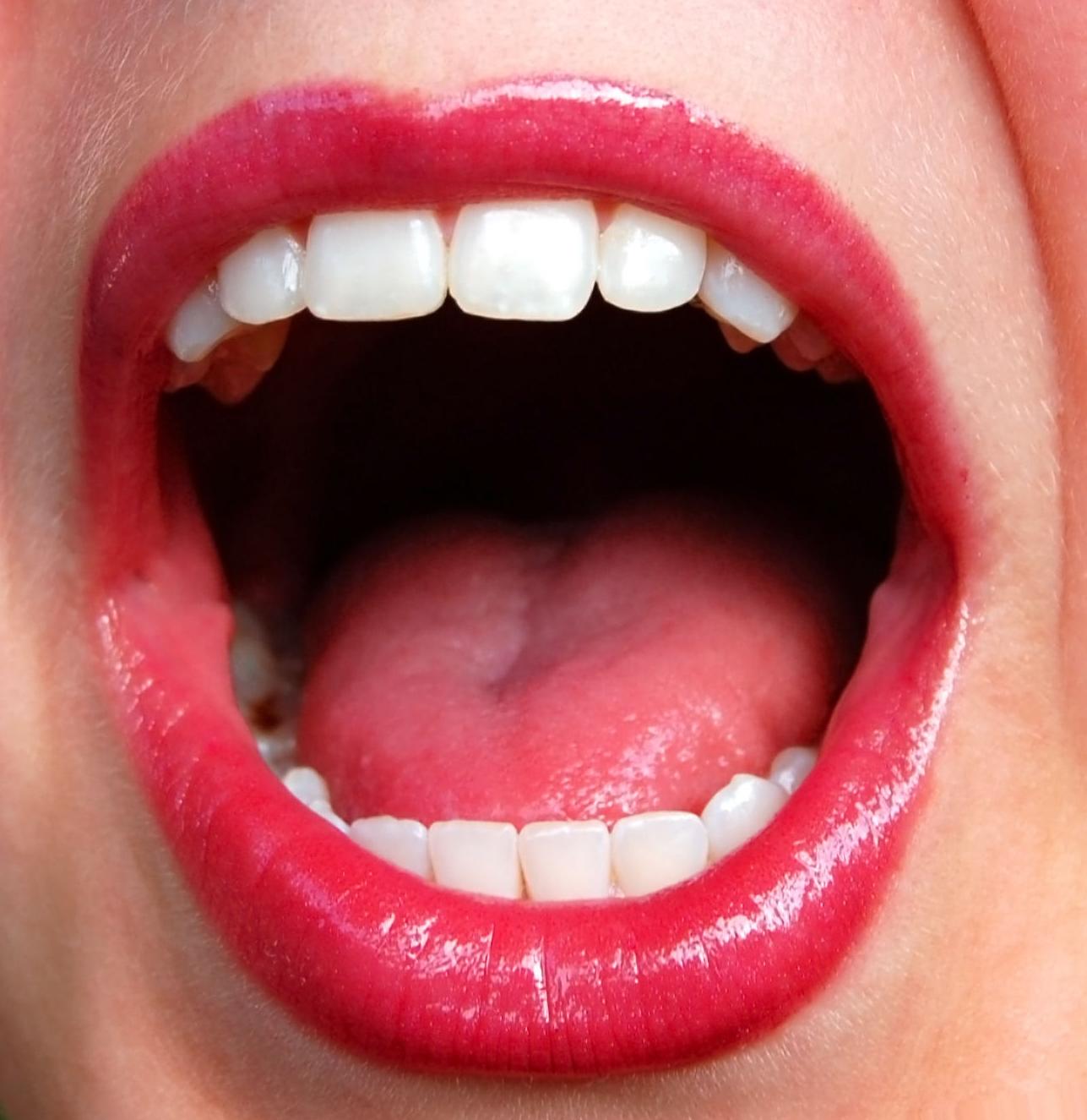 Estética (blanqueamientos, Ácido hialurónico): Tratamientos de Clinica Dental Elisa Ravojc Estética (blanqueamientos, Ácido hialurónico): Tratamientos de Clinica Dental Elisa Ravojc