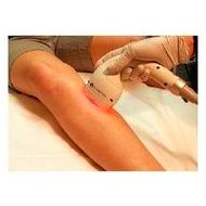 Depilación láser diodo LightSheer : Consultorio dermatológico de Quintana Doctors Depilación láser diodo LightSheer : Consultorio dermatológico de Quintana Doctors