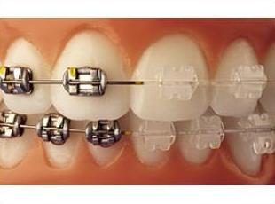 Ortodoncia niños: Tratamientos de Clínica Dental Francisco Javier García Jerónimo Ortodoncia niños: Tratamientos de Clínica Dental Francisco Javier García Jerónimo