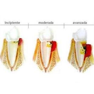 Periodoncia: Tratamientos de Clínica Dental Francisco Javier García Jerónimo Periodoncia: Tratamientos de Clínica Dental Francisco Javier García Jerónimo