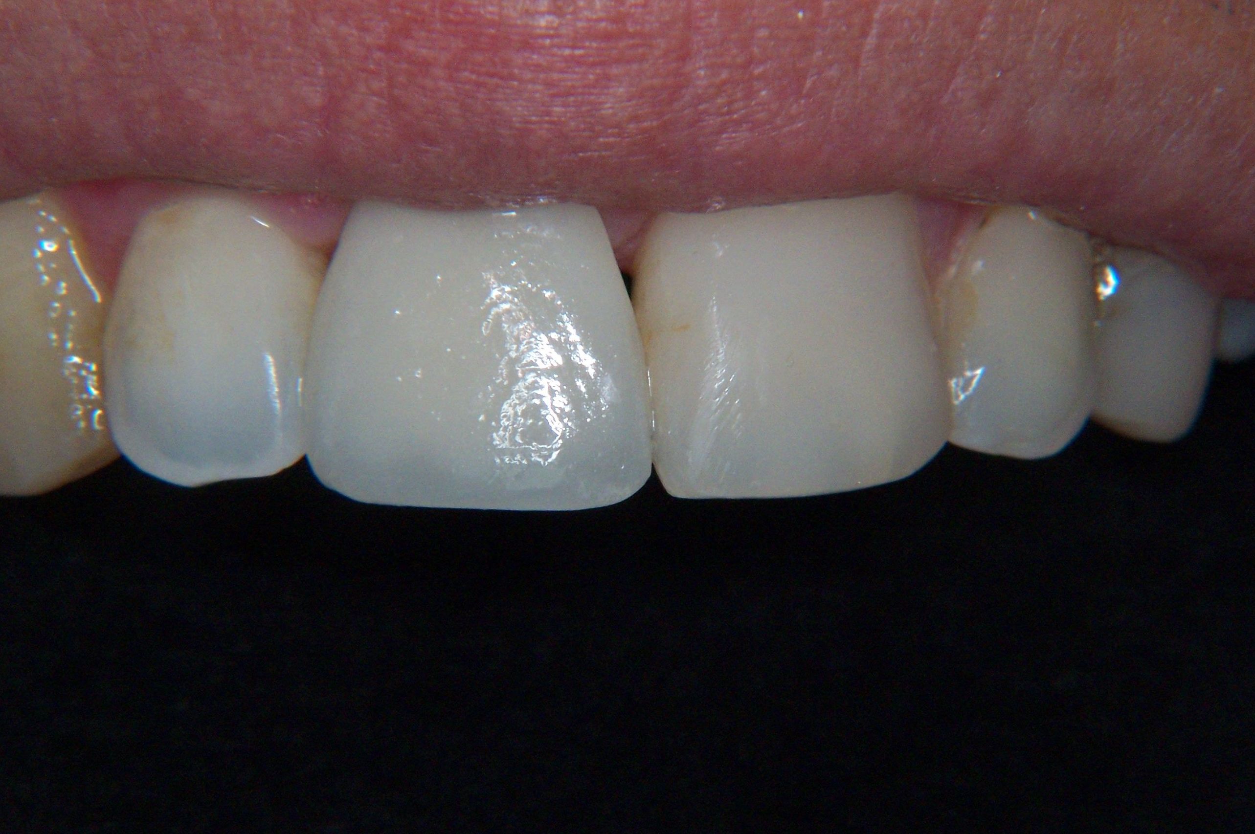 Implantes dentales: Tratamientos de Clínica Dental Francisco Javier García Jerónimo Implantes dentales: Tratamientos de Clínica Dental Francisco Javier García Jerónimo