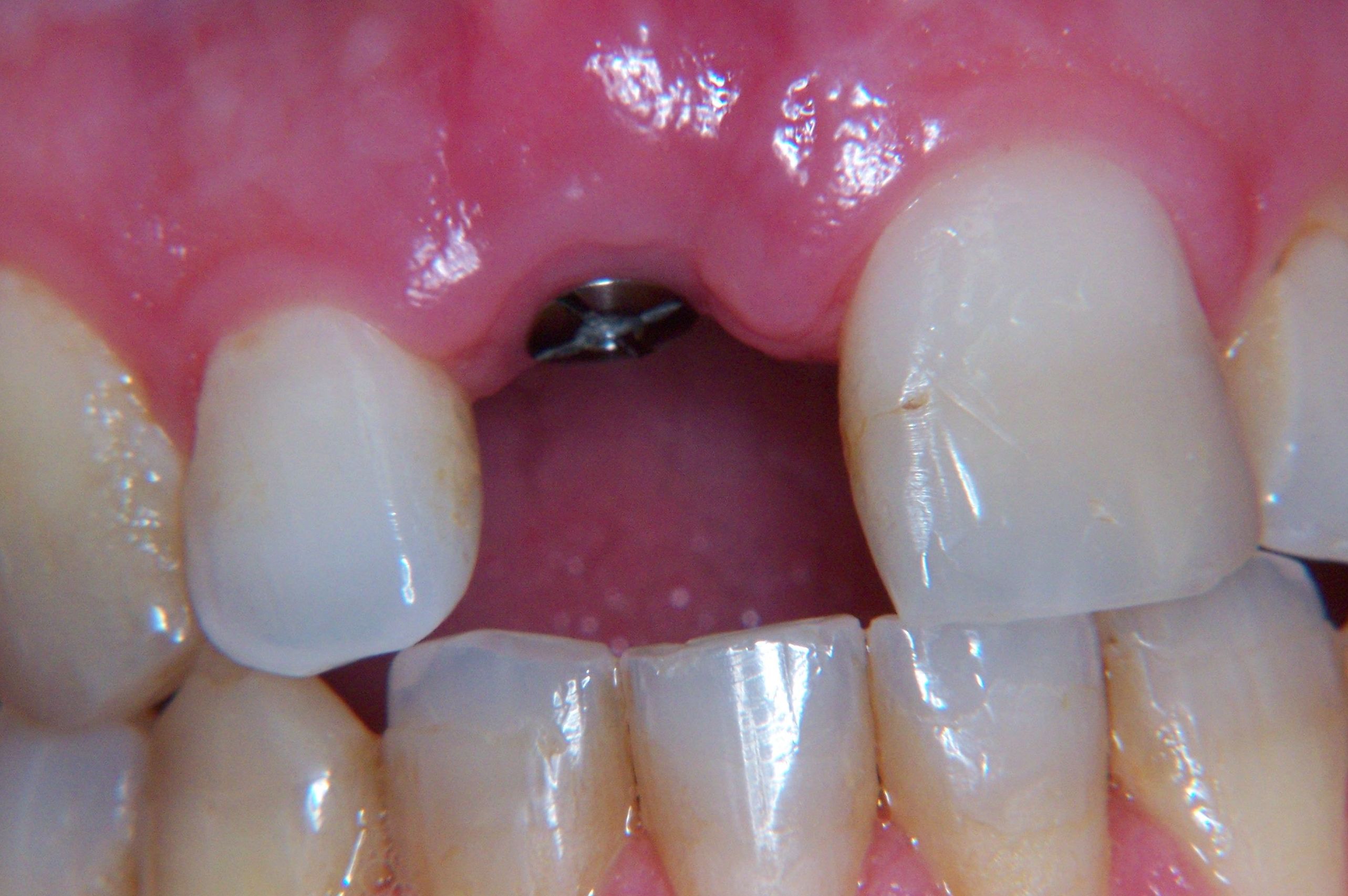 Implantes dentales: Tratamientos de Clínica Dental Francisco Javier García Jerónimo Implantes dentales: Tratamientos de Clínica Dental Francisco Javier García Jerónimo