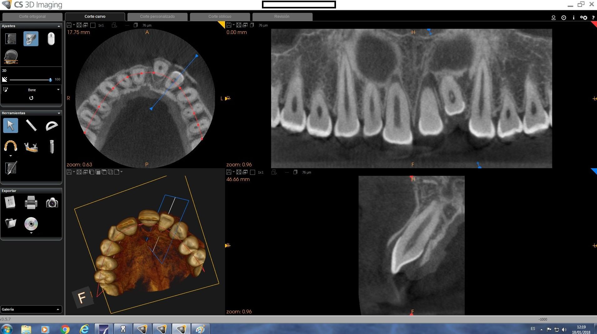 Radiología Tridimensional: Tratamientos de Clínica Dental Francisco Javier García Jerónimo Radiología Tridimensional: Tratamientos de Clínica Dental Francisco Javier García Jerónimo