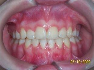 Ortodoncia adultos: Tratamientos de Clínica Dental Francisco Javier García Jerónimo Ortodoncia adultos: Tratamientos de Clínica Dental Francisco Javier García Jerónimo