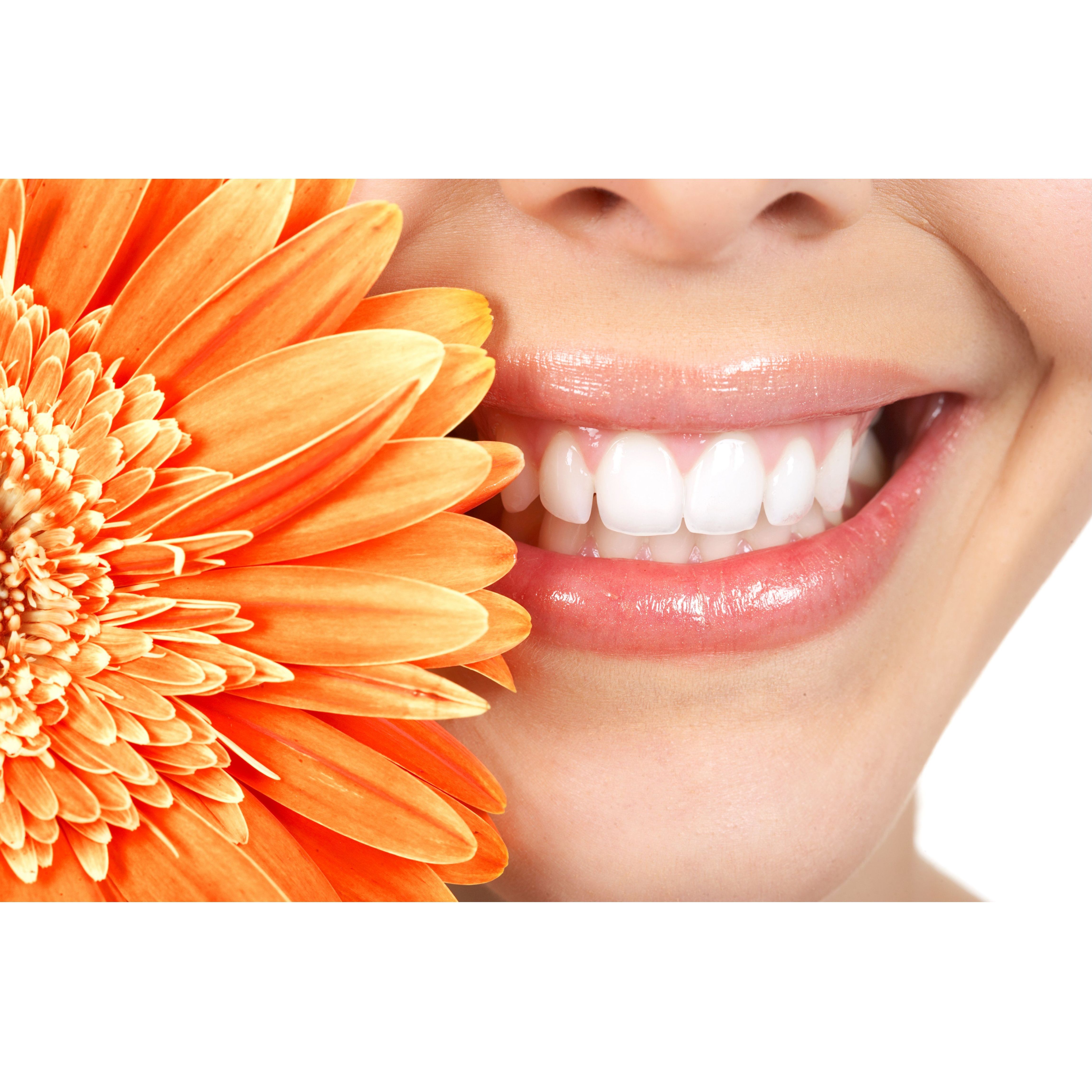 Blanqueamientos: Tratamientos Dentales de Clínica Dental Getafe Blanqueamientos: Tratamientos Dentales de Clínica Dental Getafe