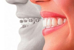 Removible: Tratamientos Dentales de Clínica Dental Getafe Removible: Tratamientos Dentales de Clínica Dental Getafe