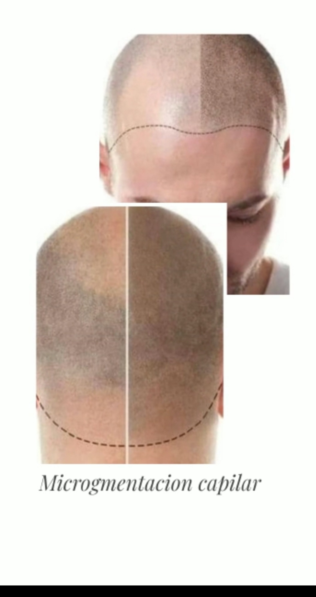 Micropigmentacion capilar: Productos de Perruquería Nova Imatge Micropigmentacion capilar: Productos de Perruquería Nova Imatge