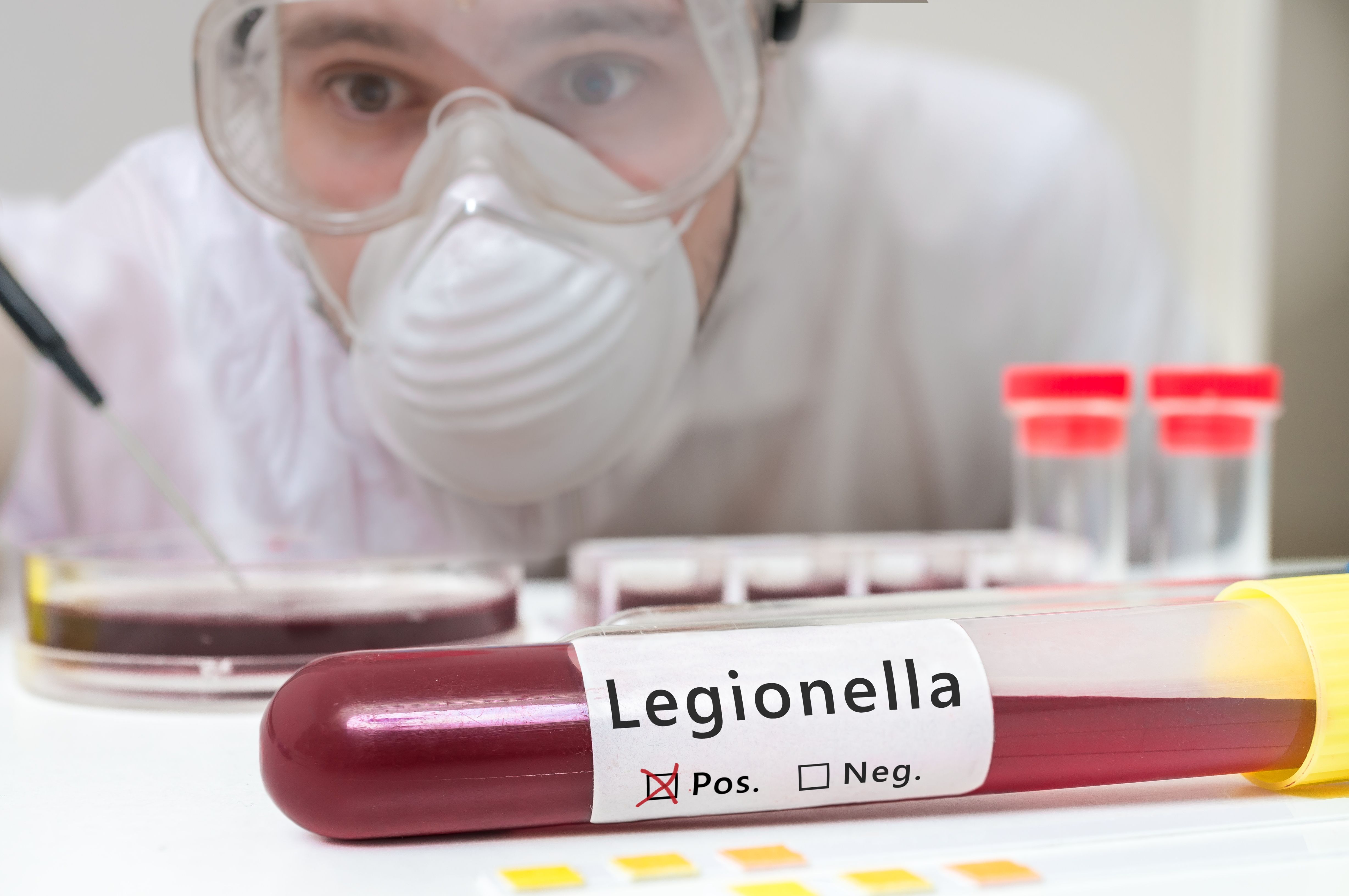 Control y prevención de Legionella: Servicios de AGP Sanidad Ambiental Control y prevención de Legionella: Servicios de AGP Sanidad Ambiental