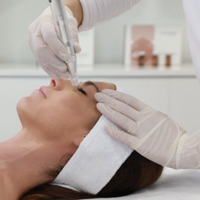 MENÚ TRATAMIENTOS CON SKIN-PEN: Natinuel cosmética bioceutica de Raquel de Líbano MENÚ TRATAMIENTOS CON SKIN-PEN: Natinuel cosmética bioceutica de Raquel de Líbano