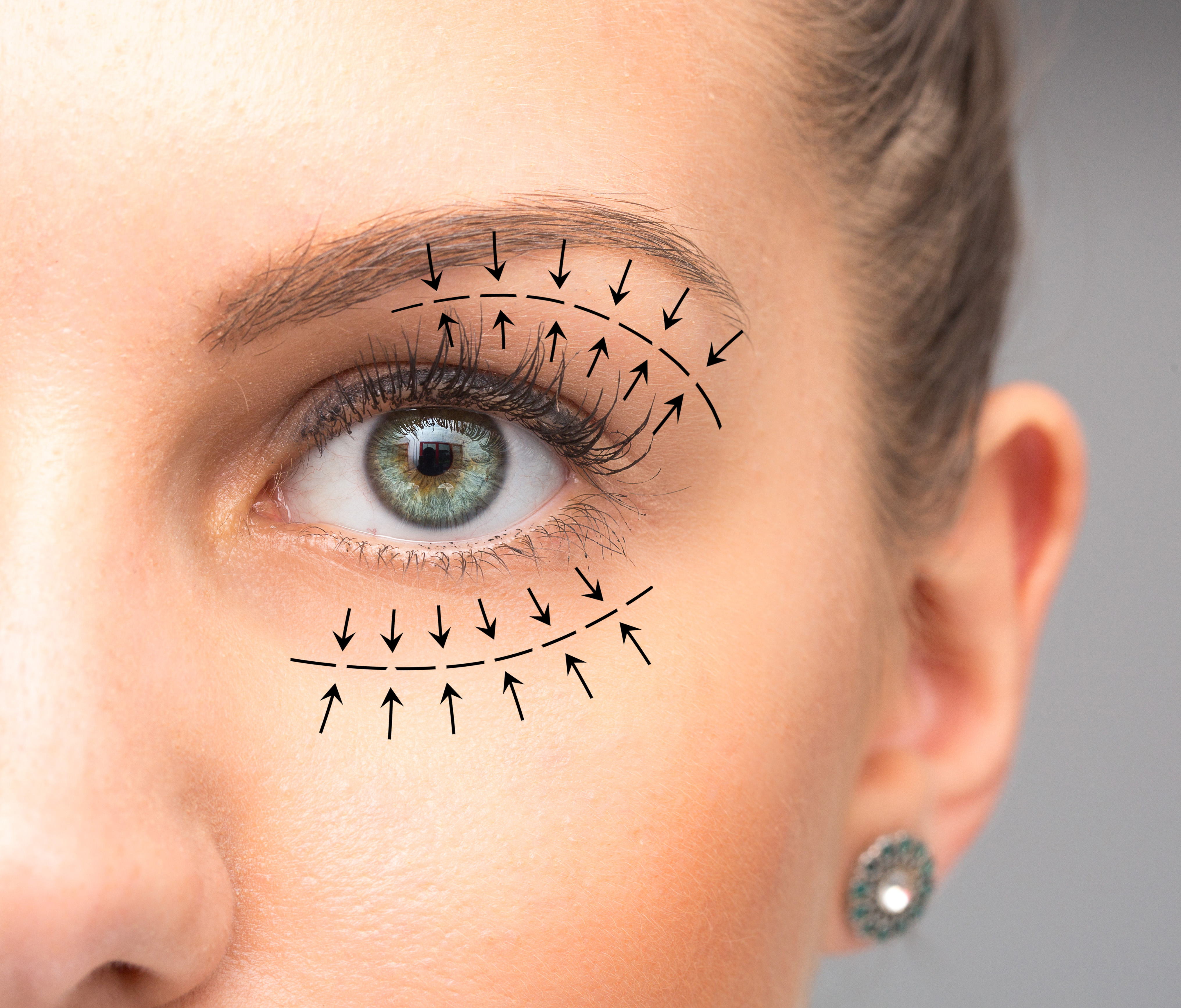 CONTORNO DE OJOS: Natinuel cosmética bioceutica de Raquel de Líbano CONTORNO DE OJOS: Natinuel cosmética bioceutica de Raquel de Líbano