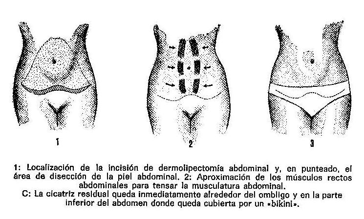 CIRUGIA DEL ABDOMEN. GALICIA. SANTIAGO.A CORUÑA. PONTEVEDRA CIRUGIA DEL ABDOMEN. GALICIA. SANTIAGO.A CORUÑA. PONTEVEDRA