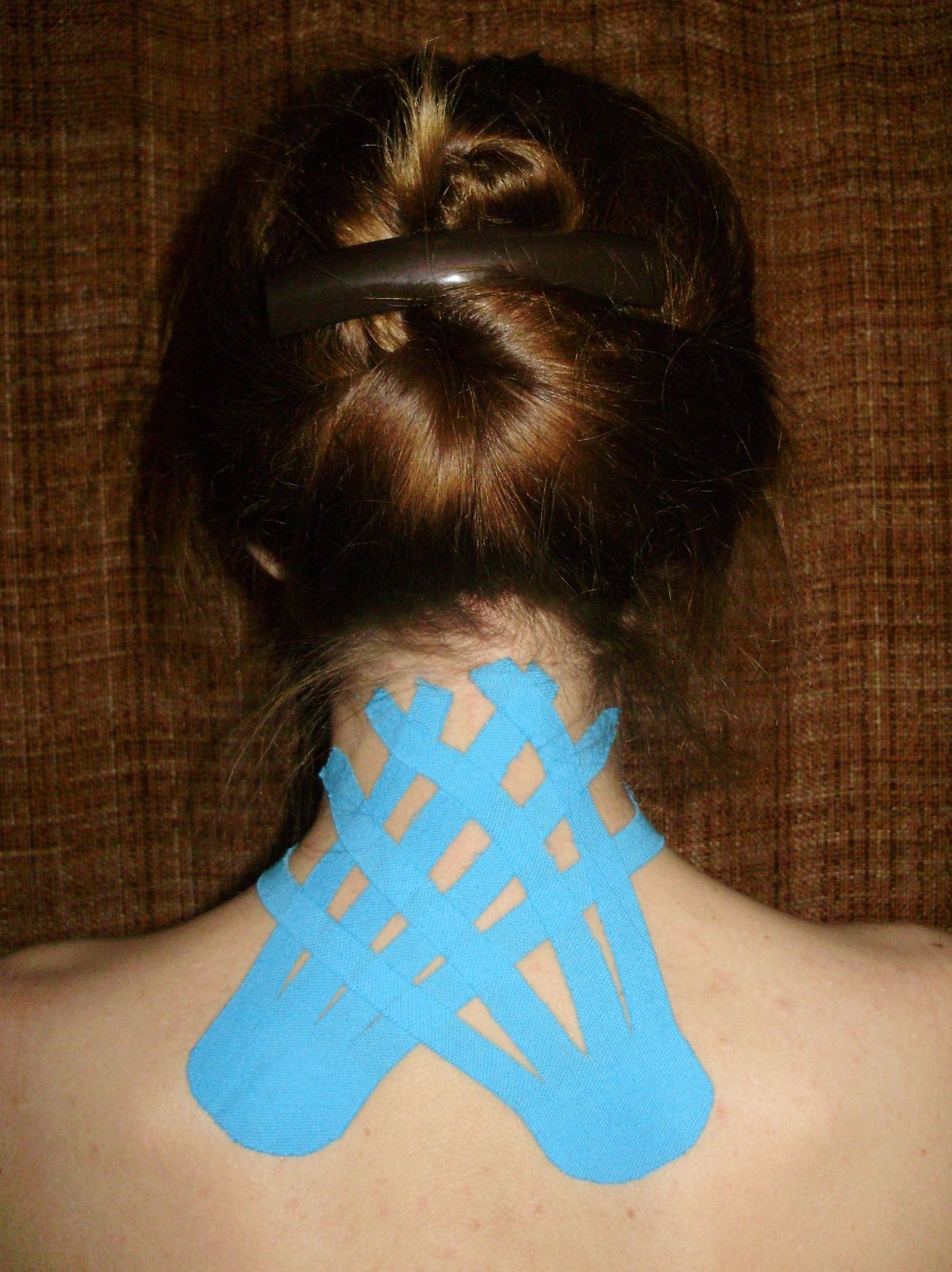 Kinesiotape estético: Servicios de Centro de Estética Paloma Olivo Kinesiotape estético: Servicios de Centro de Estética Paloma Olivo
