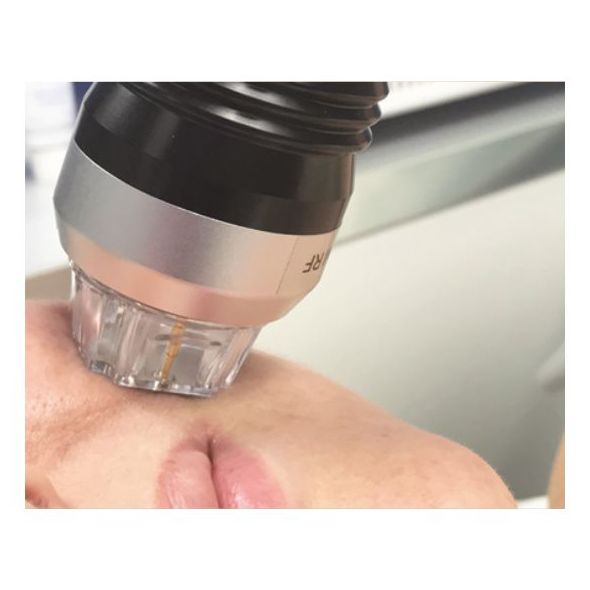 Prolex,Tratamiento antiedad reafirmante: Servicios de Centro de Estética Paloma Olivo Prolex,Tratamiento antiedad reafirmante: Servicios de Centro de Estética Paloma Olivo