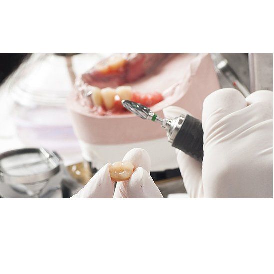 Prótesis: Tratamientos dentales de Centro Dental Sant Fost
