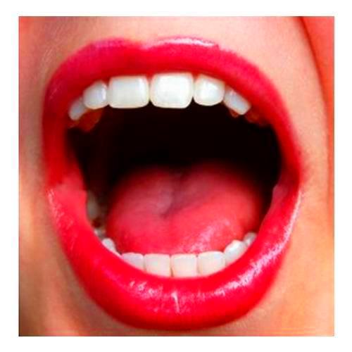 Tratamiento con ozono: Productos y servicios de Clínica Dental Carlos Michelon Tratamiento con ozono: Productos y servicios de Clínica Dental Carlos Michelon