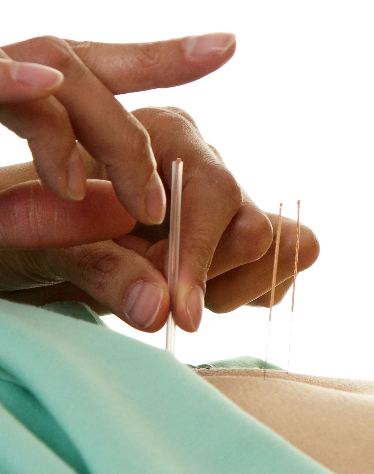 Acupuntura: Servicios de Clínica Médica San Carlos Acupuntura: Servicios de Clínica Médica San Carlos