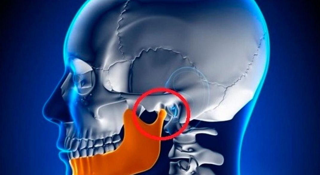 Fisioterapia de la ATM (Articulación Temporo Mandibular): Servicios de BALANÇ Fisioterapia de la ATM (Articulación Temporo Mandibular): Servicios de BALANÇ