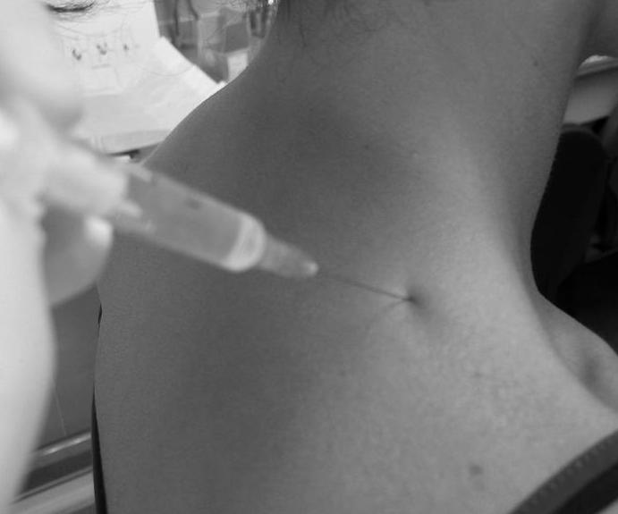 Tratamiento Dolor de Origen Musculoesquelético Asturias Tratamiento Dolor de Origen Musculoesquelético Asturias