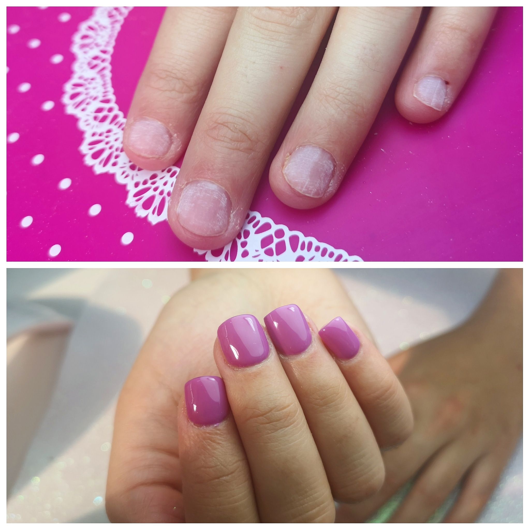 Reconstrucción de uñas mordidas: Servicios de Cristina Nails Reconstrucción de uñas mordidas: Servicios de Cristina Nails