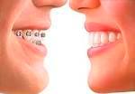ORTODONCIA: Tratamientos de Clínica Dental Ángel Artiz ORTODONCIA: Tratamientos de Clínica Dental Ángel Artiz