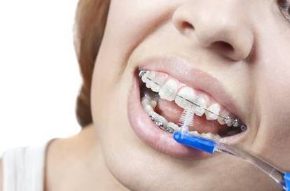 Una correcta higiene dental, clave para si ortodoncia y su salud.