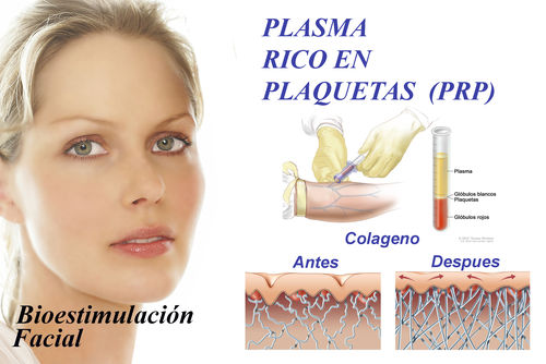 Plasma rico en plaquetas (PRP): Tratamientos y Productos de Odontología Integral Fernando Román Plasma rico en plaquetas (PRP): Tratamientos y Productos de Odontología Integral Fernando Román