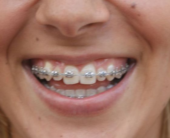 Ortodoncia: Servicios de Clínica Dental Casimiro Sinde Pereiro Ortodoncia: Servicios de Clínica Dental Casimiro Sinde Pereiro