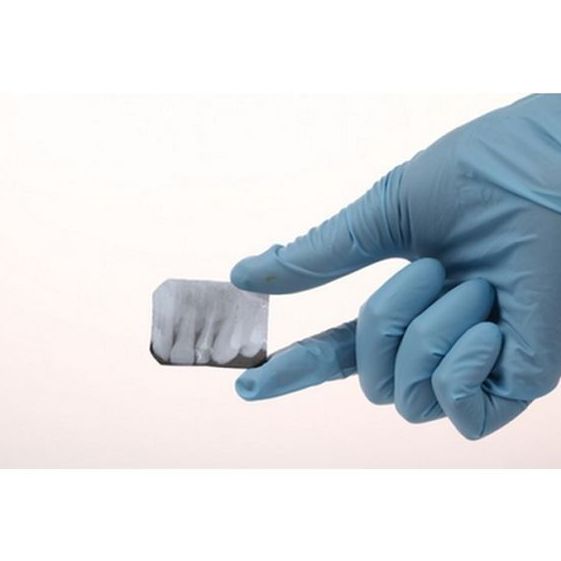 Radiografía dental: Servicios de Clínica Dental Casimiro Sinde Pereiro Radiografía dental: Servicios de Clínica Dental Casimiro Sinde Pereiro