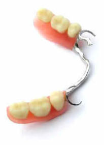 Prótesis dental removible en Santiago de Compostela Prótesis dental removible en Santiago de Compostela
