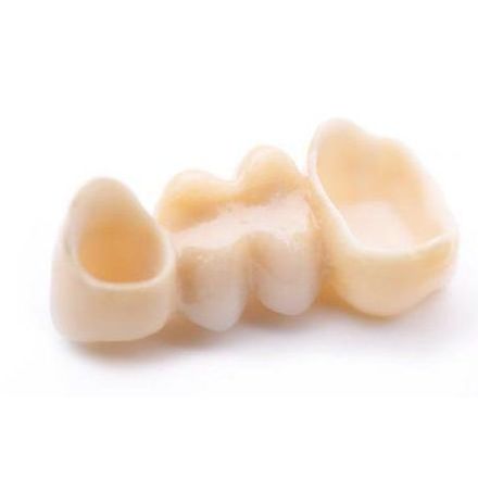 Prótesis fija: Especialidades odontológicas: de Clínica Dental Jorge del Corral Prótesis fija: Especialidades odontológicas: de Clínica Dental Jorge del Corral
