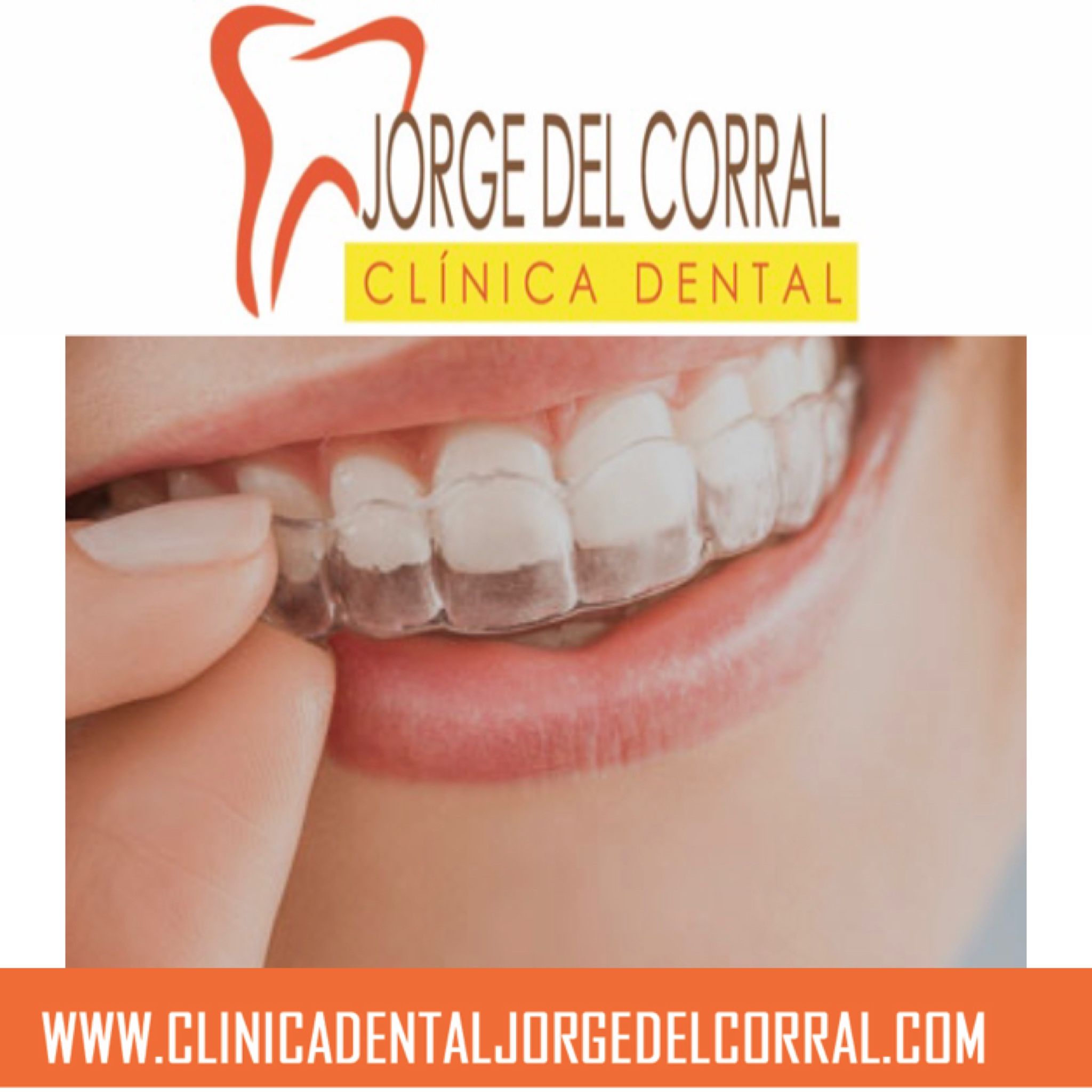 Foto 140 de Odontología general en Madrid | Clínica Dental Jorge del Corral
