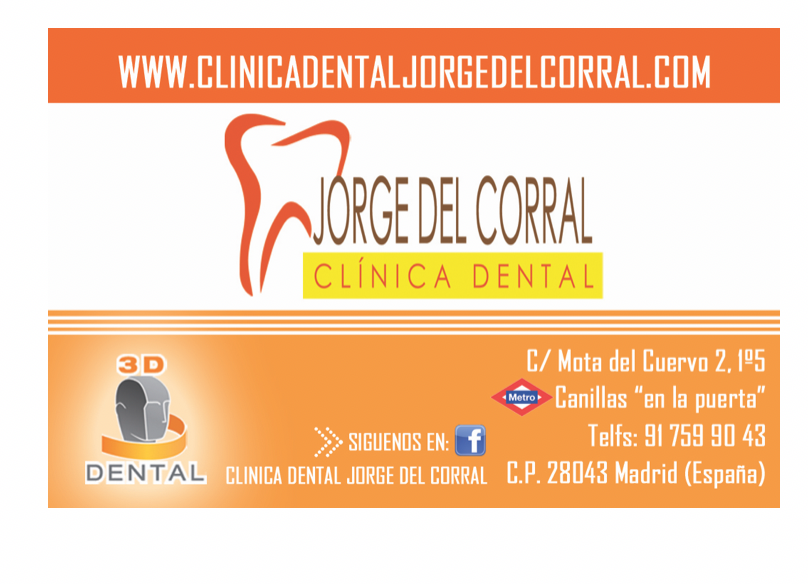 Carillas dentales estéticas en Madrid Carillas dentales estéticas en Madrid