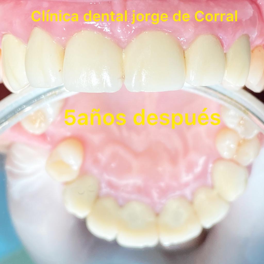 CLÍNICA DENTAL MADRID-HORTALEZA: Especialidades odontológicas: de Clínica Dental Jorge del Corral CLÍNICA DENTAL MADRID-HORTALEZA: Especialidades odontológicas: de Clínica Dental Jorge del Corral