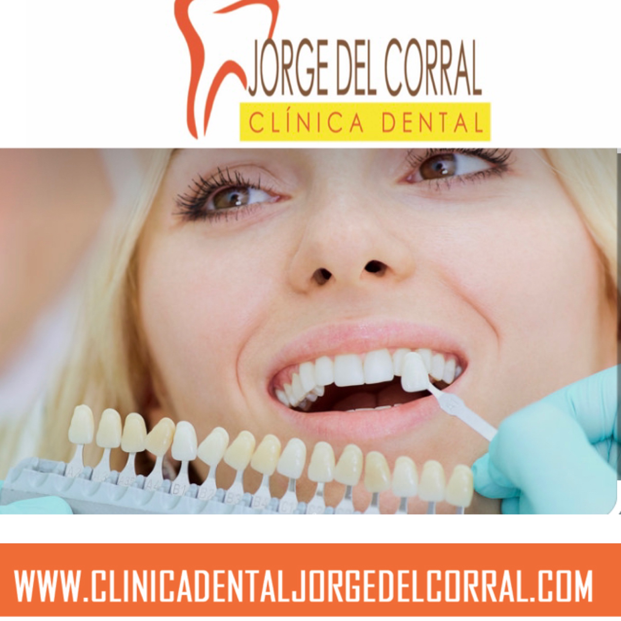 Revisión dental Hortaleza Canillas Madrid Revisión dental Hortaleza Canillas Madrid