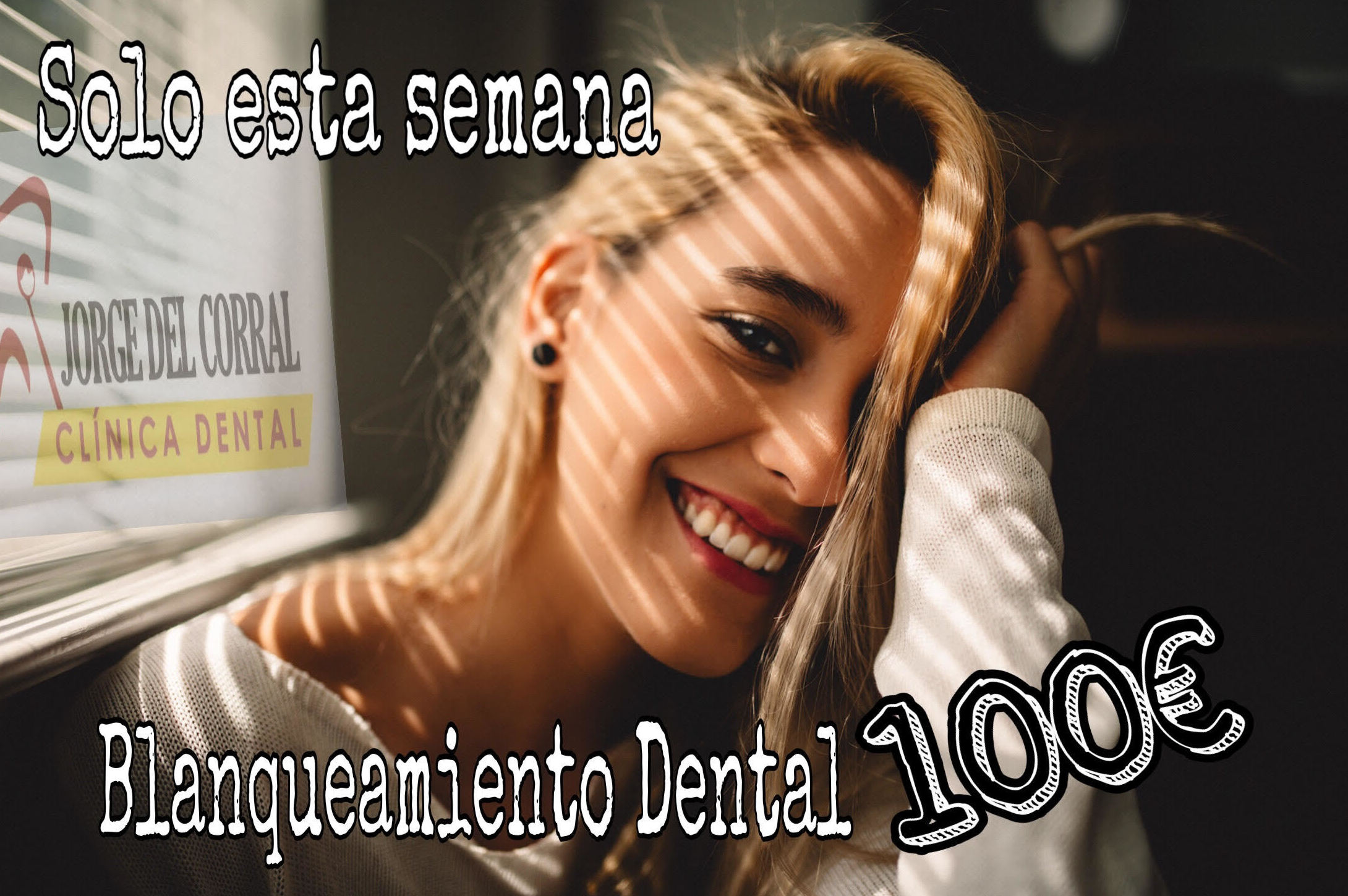 Blanqueamiento dentales en Hortaleza