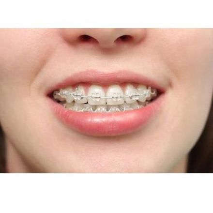 -20% Ortodoncia: Especialidades odontológicas: de Clínica Dental Jorge del Corral -20% Ortodoncia: Especialidades odontológicas: de Clínica Dental Jorge del Corral