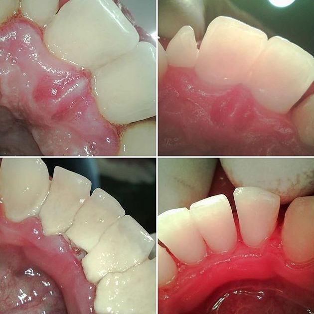 Periodoncia: Servicios de Clínica dental ulident Periodoncia: Servicios de Clínica dental ulident