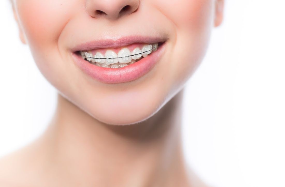 Ortodoncia: Especialidades de Clínica Dental Larumbe y Jiménez Ortodoncia: Especialidades de Clínica Dental Larumbe y Jiménez